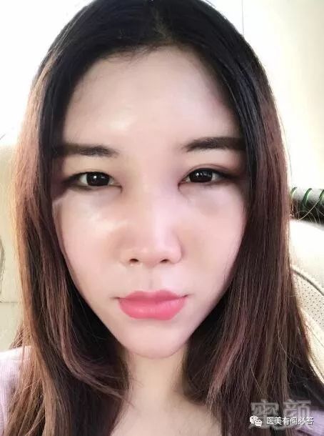 https://img.miyanlife.com/mnt/timg/180301/1321493O1-1.jpg