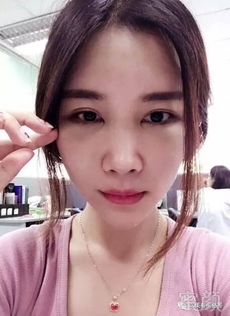 https://img.miyanlife.com/mnt/timg/180301/1321495U4-2.jpg