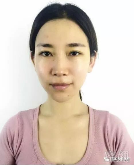 https://img.miyanlife.com/mnt/timg/180301/13214Sa1-0.jpg