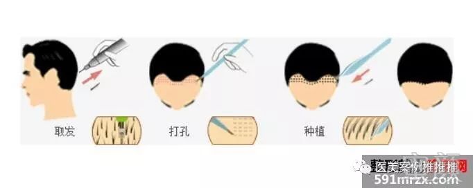 https://img.miyanlife.com/mnt/timg/180301/1325561191-0.jpg