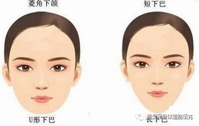 https://img.miyanlife.com/mnt/timg/180301/1330593B6-0.jpg