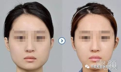 https://img.miyanlife.com/mnt/timg/180301/13310042H-1.jpg