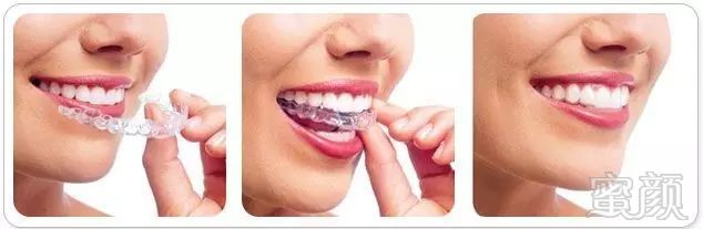 https://img.miyanlife.com/mnt/timg/180301/13312350L-18.jpg