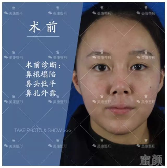 https://img.miyanlife.com/mnt/timg/180301/1335532596-8.jpg