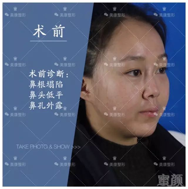 https://img.miyanlife.com/mnt/timg/180301/1335551T4-9.jpg