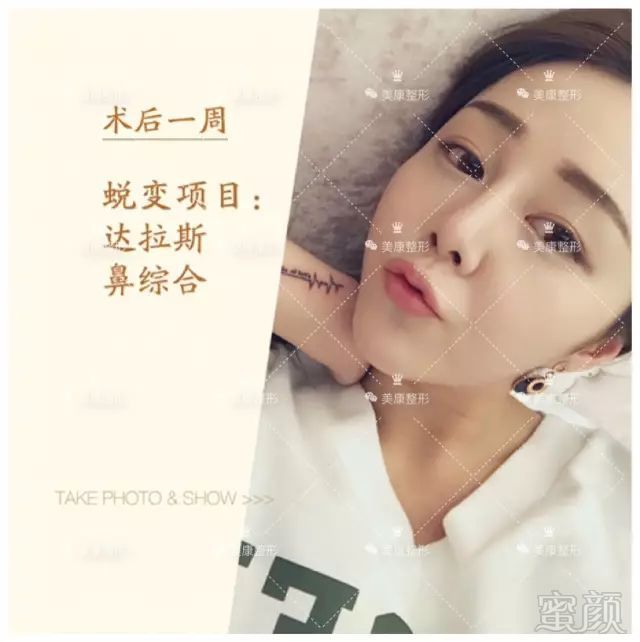 https://img.miyanlife.com/mnt/timg/180301/13355614W-12.jpg