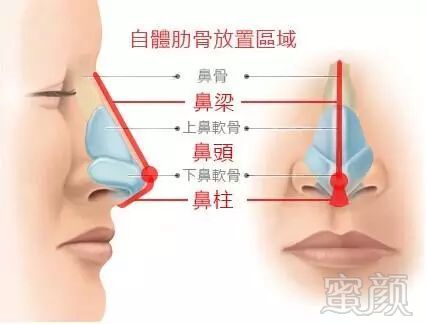 https://img.miyanlife.com/mnt/timg/180301/1335562121-10.jpg