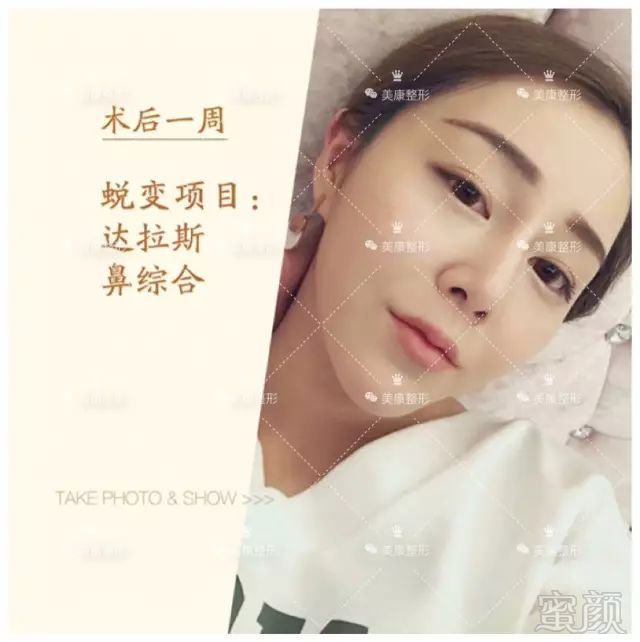 https://img.miyanlife.com/mnt/timg/180301/13355C192-11.jpg