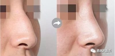 https://img.miyanlife.com/mnt/timg/180301/133Z2E17-1.jpg
