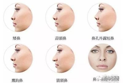 https://img.miyanlife.com/mnt/timg/180301/133Z33Q0-2.jpg