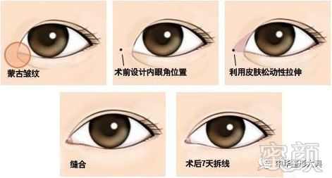 https://img.miyanlife.com/mnt/timg/180301/13422C306-2.jpg