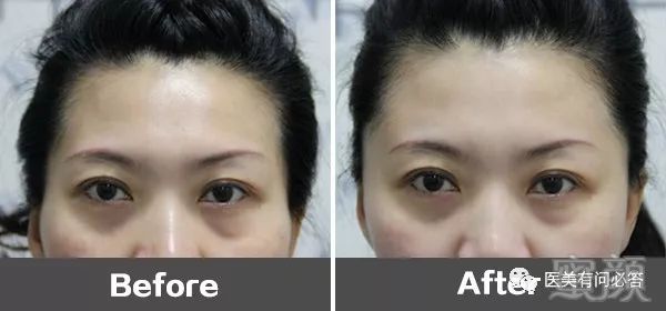 https://img.miyanlife.com/mnt/timg/180301/13430BI5-0.jpg