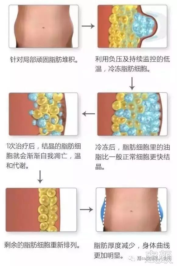 https://img.miyanlife.com/mnt/timg/180301/1345315C9-0.jpg