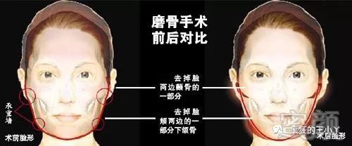 https://img.miyanlife.com/mnt/timg/180302/10333K245-0.jpg