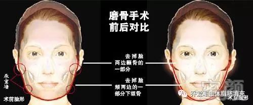 https://img.miyanlife.com/mnt/timg/180302/10335IP9-2.jpg