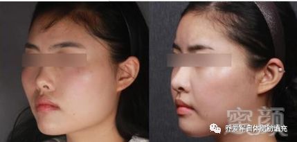 https://img.miyanlife.com/mnt/timg/180302/10335T116-5.jpg