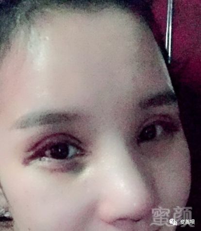 https://img.miyanlife.com/mnt/timg/180302/1114396020-2.jpg