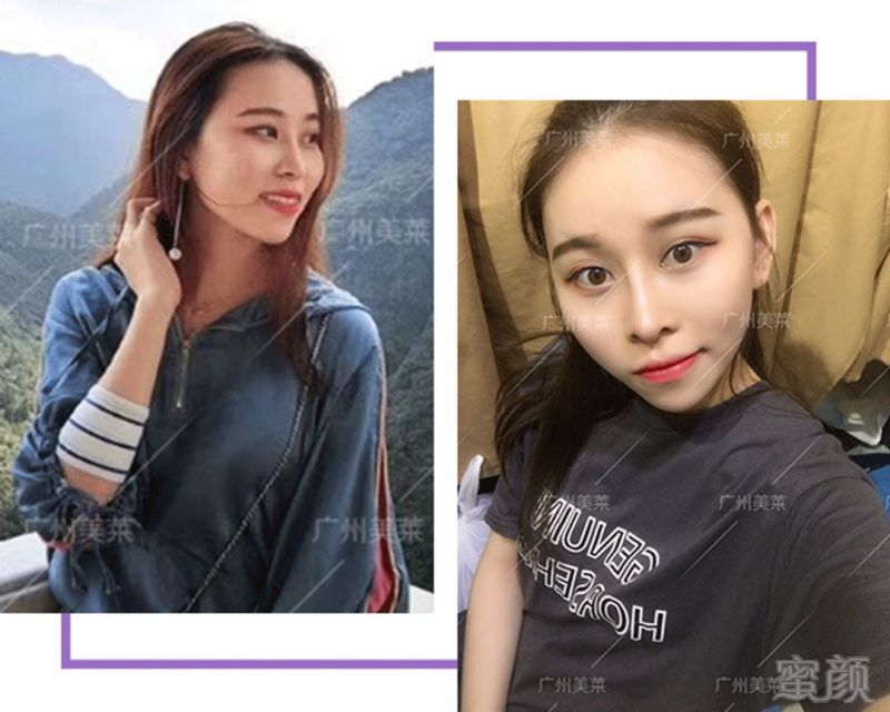 https://img.miyanlife.com/mnt/timg/180302/112640HL-4.jpg