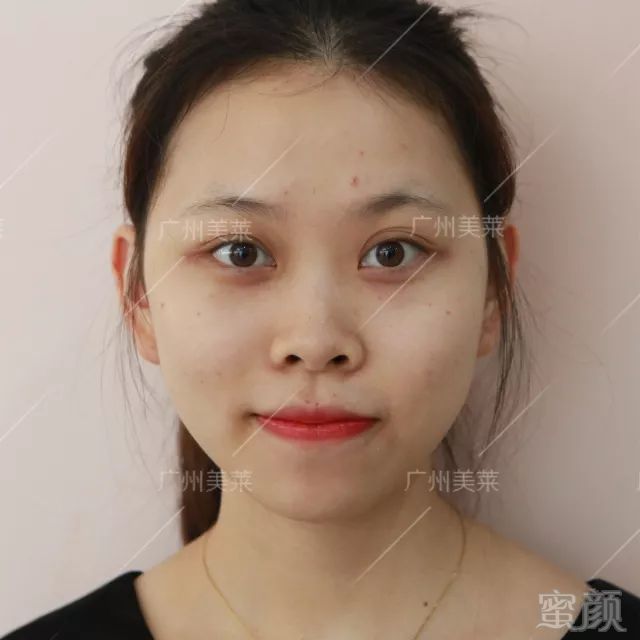https://img.miyanlife.com/mnt/timg/180302/112640I52-2.jpg