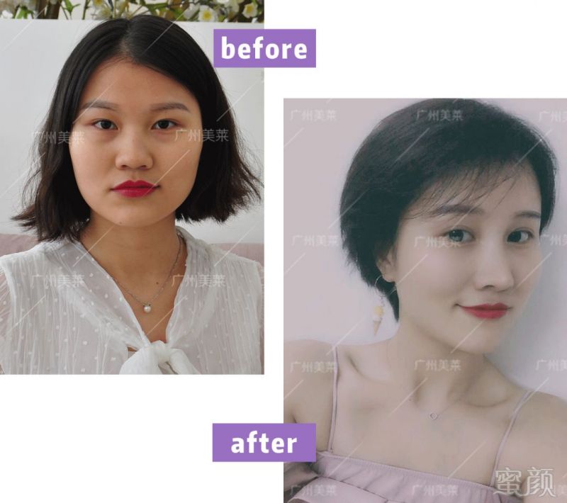 https://img.miyanlife.com/mnt/timg/180302/1126412928-6.jpg