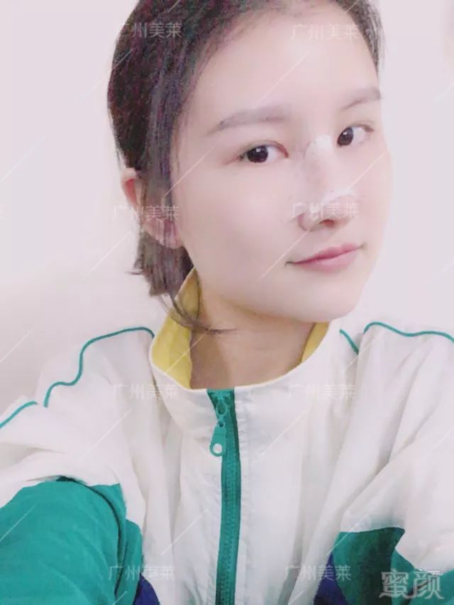 https://img.miyanlife.com/mnt/timg/180302/112A3I50-15.jpg
