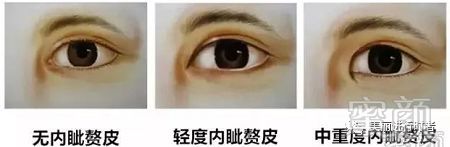https://img.miyanlife.com/mnt/timg/180302/113Q02c9-3.jpg