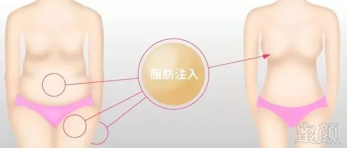 https://img.miyanlife.com/mnt/timg/180302/114P0O93-3.jpg