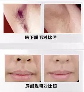 https://img.miyanlife.com/mnt/timg/180302/1151022N9-14.jpg