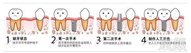 https://img.miyanlife.com/mnt/timg/180302/12110211T-0.jpg