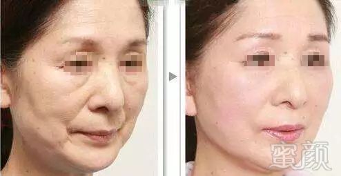 https://img.miyanlife.com/mnt/timg/180302/1211551392-13.jpg