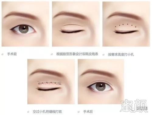 https://img.miyanlife.com/mnt/timg/180302/12140941T-1.jpg