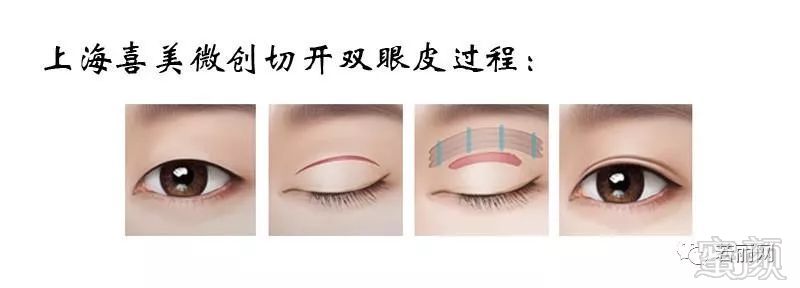 https://img.miyanlife.com/mnt/timg/180302/1214094M6-0.jpg