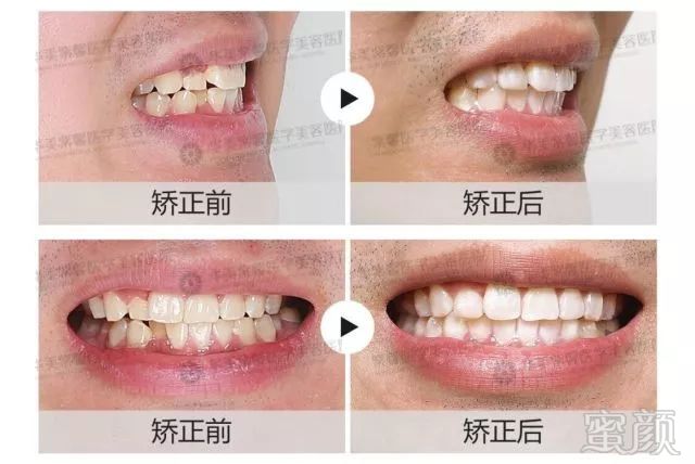 https://img.miyanlife.com/mnt/timg/180302/12151R960-17.jpg