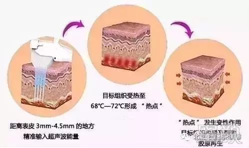 案例图片