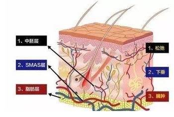 案例图片