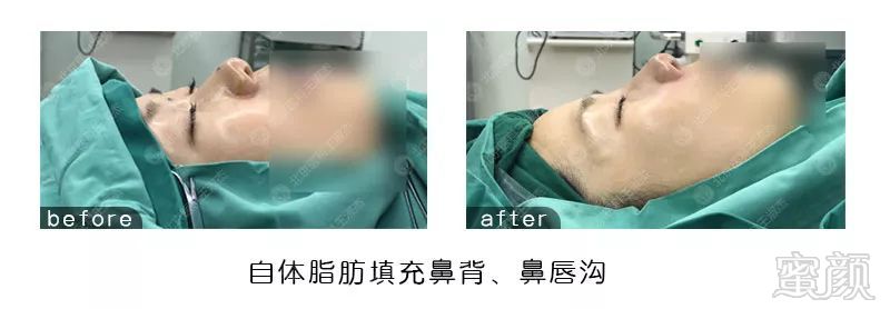 https://img.miyanlife.com/mnt/timg/180302/12221S521-1.jpg