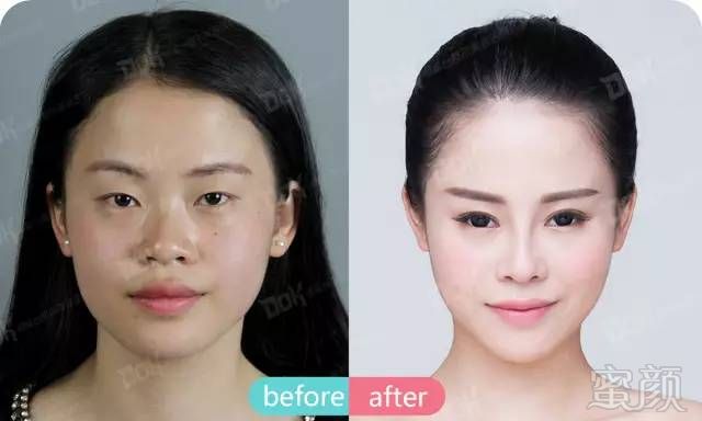 https://img.miyanlife.com/mnt/timg/180302/1232145226-11.jpg