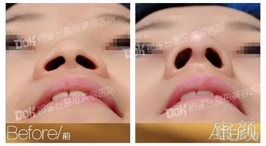 https://img.miyanlife.com/mnt/timg/180302/1232151261-15.jpg