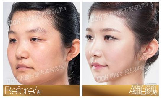 https://img.miyanlife.com/mnt/timg/180302/1232152c8-12.jpg