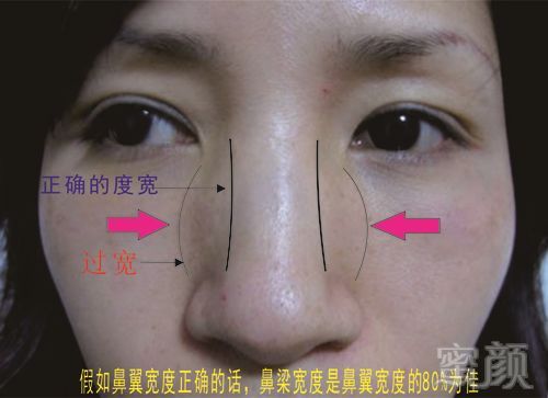 https://img.miyanlife.com/mnt/timg/180303/101452G56-2.jpg