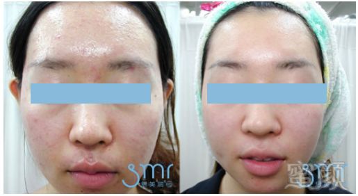 https://img.miyanlife.com/mnt/timg/180303/1020234c0-6.jpg