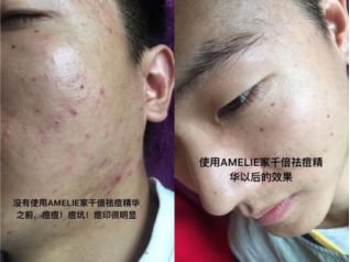 https://img.miyanlife.com/mnt/timg/180303/10291J947-6.jpg