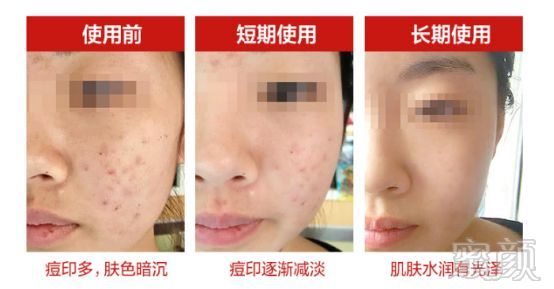https://img.miyanlife.com/mnt/timg/180303/10291R240-8.jpg