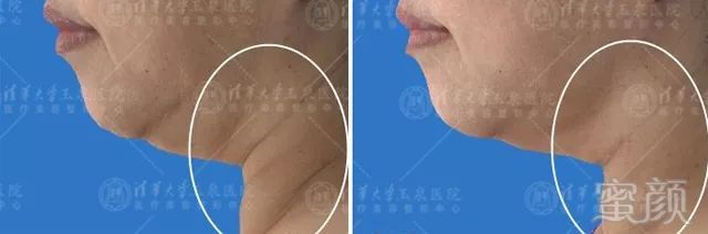 https://img.miyanlife.com/mnt/timg/180303/102P95b3-3.jpg