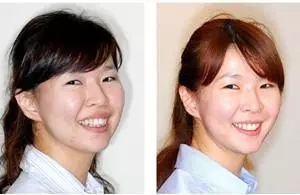 https://img.miyanlife.com/mnt/timg/180303/111942Ba-10.jpg