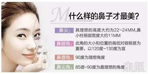 https://img.miyanlife.com/mnt/timg/180303/11214L433-4.jpg