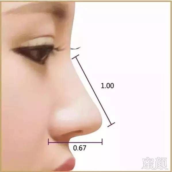 https://img.miyanlife.com/mnt/timg/180303/11214R047-9.jpg