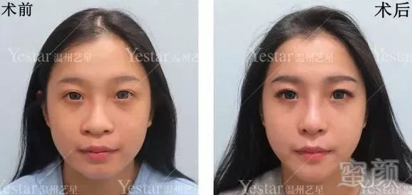 https://img.miyanlife.com/mnt/timg/180303/11345R210-3.jpg