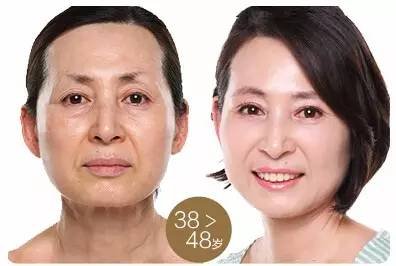 https://img.miyanlife.com/mnt/timg/180303/1159302200-6.jpg