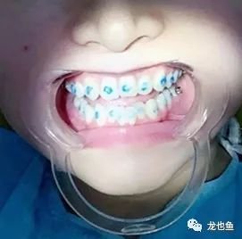 https://img.miyanlife.com/mnt/timg/180303/122A033L-3.jpg